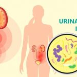 Hur påverkar urinvägsinfektioner din träning och vad du kan göra åt det